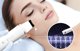 Anlan Peeling Καθαρισμού με Κύματα ANLAN 01-ACPJ32-02A (Λευκό)