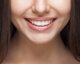 Curaprox CURAPROX PERIO PLUS+ GEL 0,50 CHX 10ML