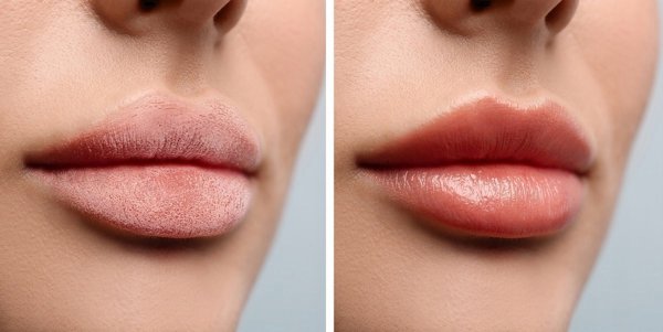 Eveline SOS Προστατευτικό Κραγιόν Exotic Mango