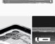 Θήκη Spigen Ultra Hybrid Mag MagSafe για Samsung Galaxy S25 λευκό