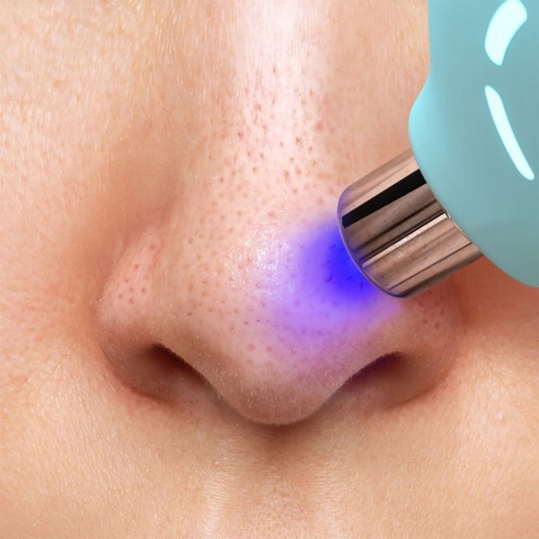 Foreo KIWI Συσκευή Καθαρισμού Προσώπου με Κενό Αέρος, Γκρι