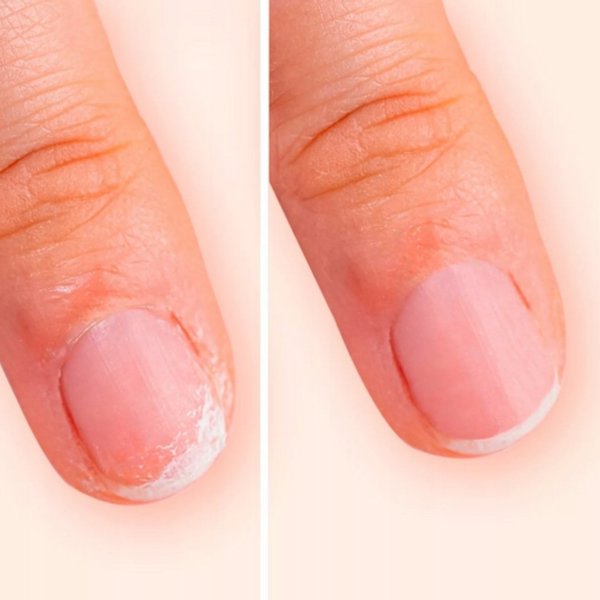 MANUCURIST Keratine Booster ενισχυτική λοσιόν για νύχια 15ml