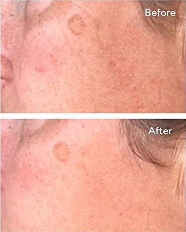 MURAD_Correct And Protect Serum ορός προσώπου SPF45 30ml