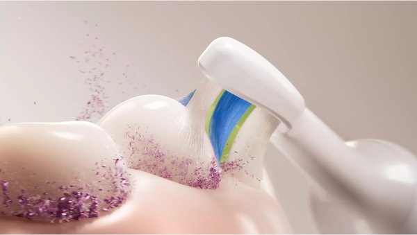 Philips Ηλεκτρική Οδοντόβουρτσα Sonicare HX7119/01, Σετ Οδοντόβουρτσας, Λευκό